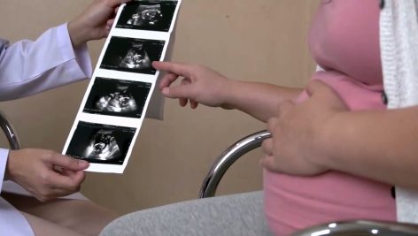 Ultrasound of a pregnant woman